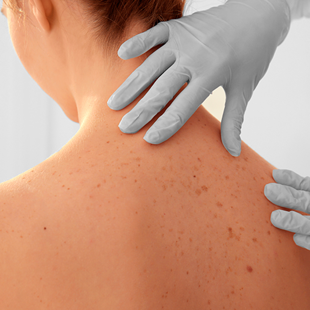 dermatologia